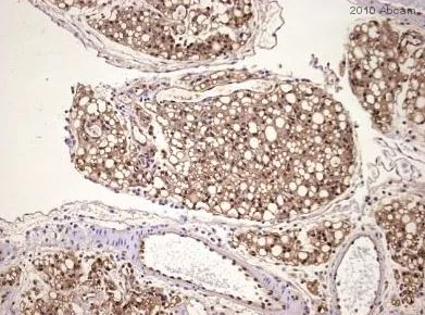 Immunohistochemistry (Formalin/PFA-fixed paraffin-embedded sections) - Anti-FABP4 antibody (AB13979)