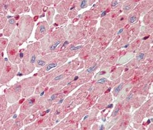 Immunohistochemistry (Formalin/PFA-fixed paraffin-embedded sections) - Anti-FABP4 antibody (AB195657)