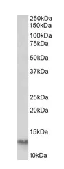 Western blot - Anti-FABP4 antibody (AB195657)