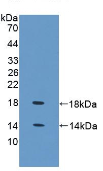 Western blot - Anti-FABP4 antibody (AB231067), expandable thumbnail