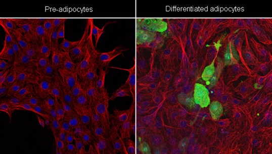 Immunocytochemistry/ Immunofluorescence - Anti-FABP4 antibody [EPR3579] (AB92501), expandable thumbnail