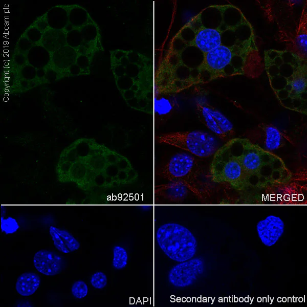 Immunocytochemistry/ Immunofluorescence - Anti-FABP4 antibody [EPR3579] (AB92501)