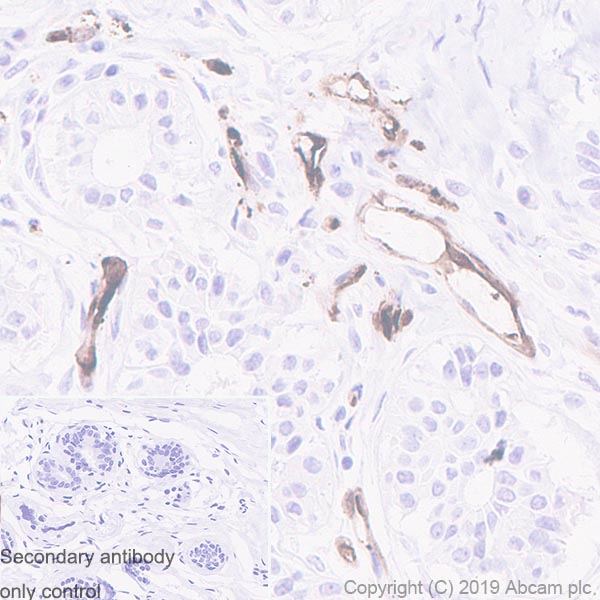 Immunohistochemistry (Formalin/PFA-fixed paraffin-embedded sections) - Anti-FABP4 antibody [EPR3579] (AB92501), expandable thumbnail
