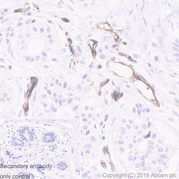 Immunohistochemistry (Formalin/PFA-fixed paraffin-embedded sections) - Anti-FABP4 antibody [EPR3579] (AB92501)