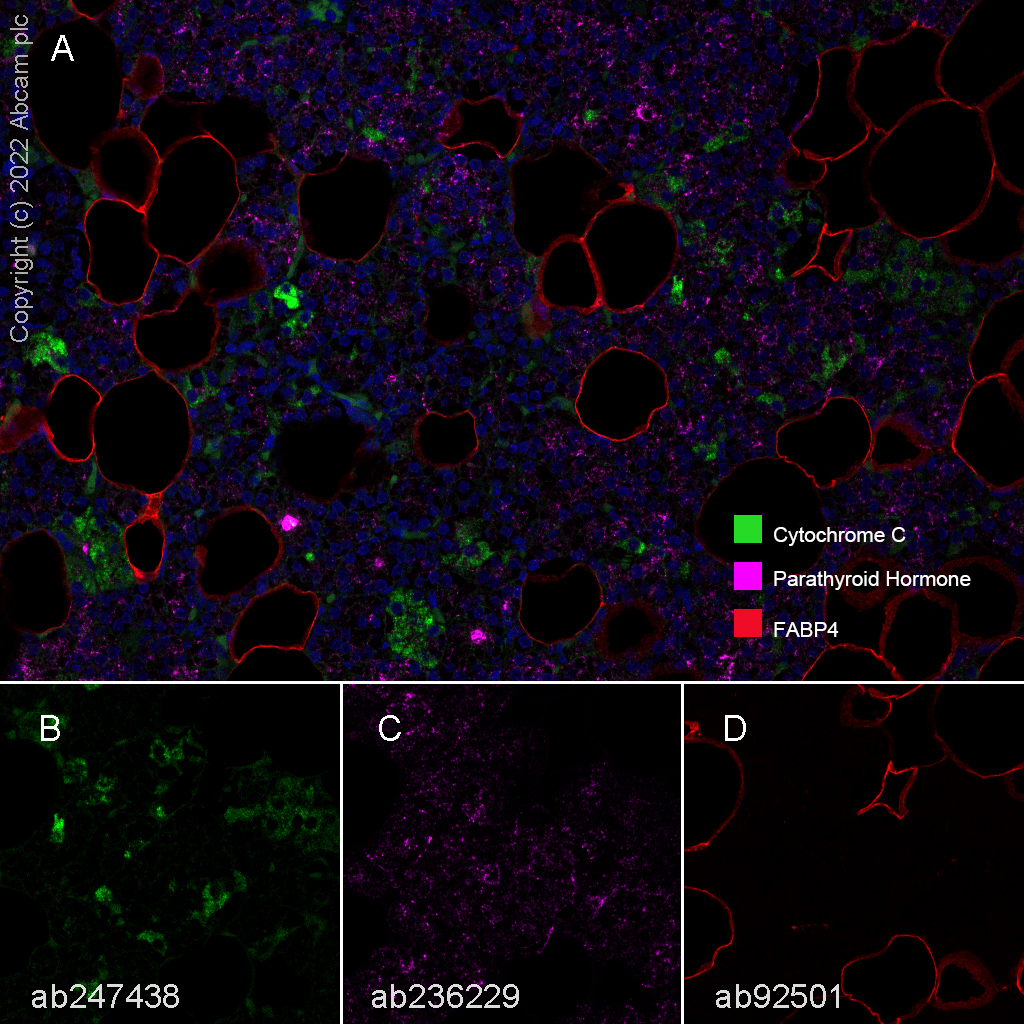 Multiplex immunohistochemistry - Anti-FABP4 antibody [EPR3579] (ab92501), expandable thumbnail