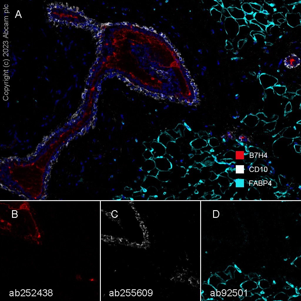 Multiplex immunohistochemistry - Anti-FABP4 antibody [EPR3579] (AB92501), expandable thumbnail