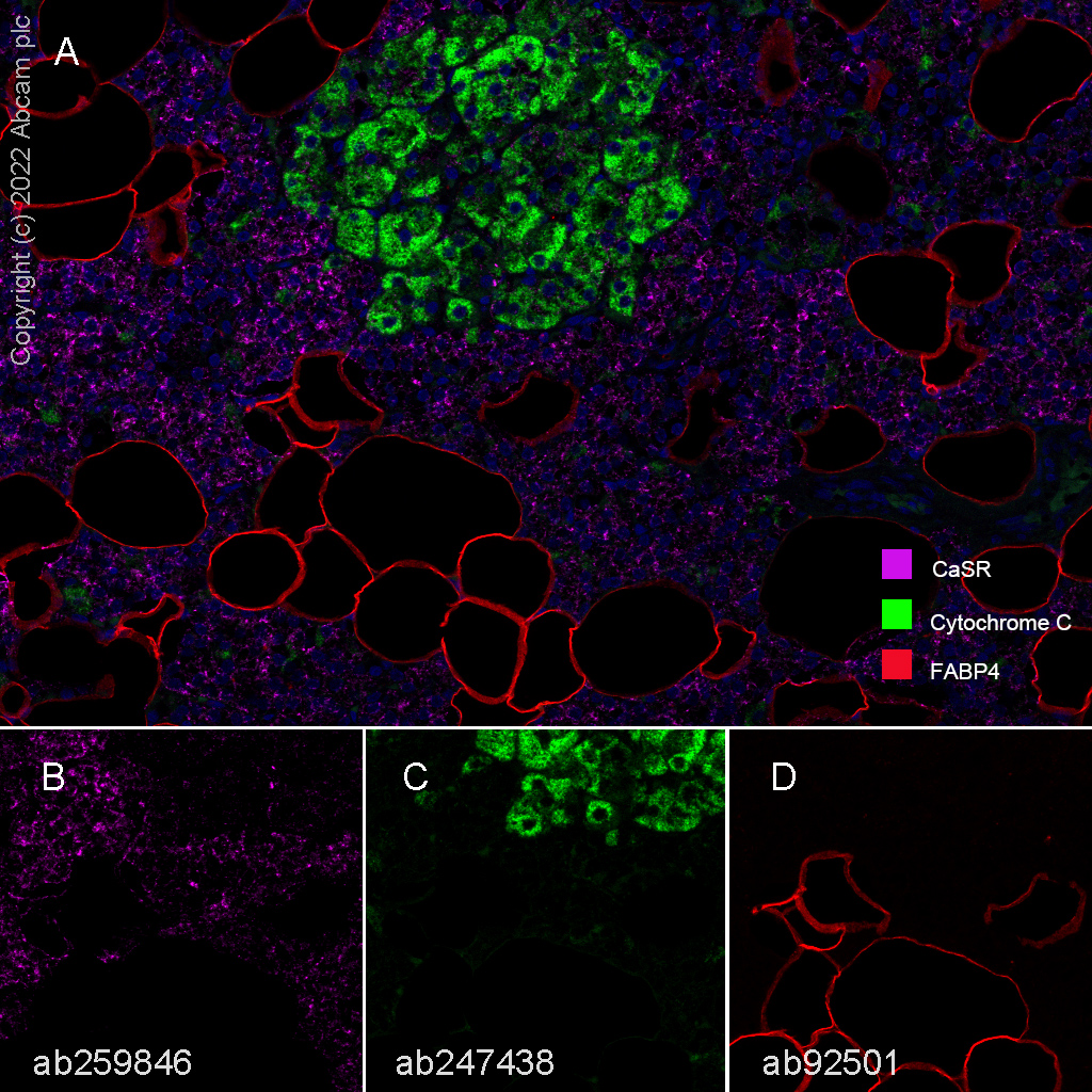 Multiplex immunohistochemistry - Anti-FABP4 antibody [EPR3579] - BSA and Azide free (AB219595)
