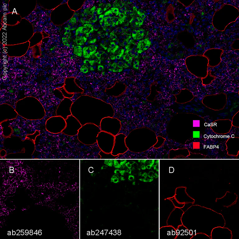 Multiplex immunohistochemistry - Anti-FABP4 antibody [EPR3579] - BSA and Azide free (AB219595)