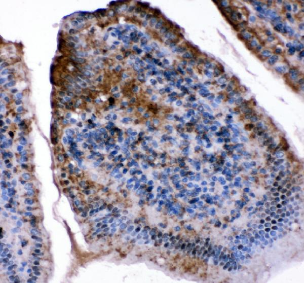 Immunohistochemistry (Formalin/PFA-fixed paraffin-embedded sections) - Anti-FABP5 antibody (AB151772), expandable thumbnail