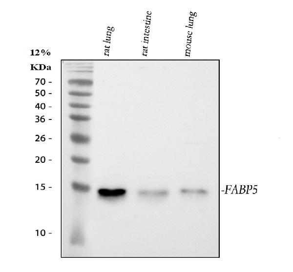 Western blot - Anti-FABP5 antibody (AB151772), expandable thumbnail