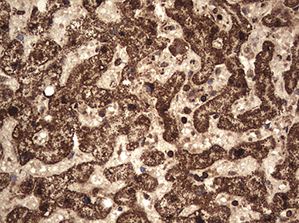 Immunohistochemistry (Formalin/PFA-fixed paraffin-embedded sections) - Anti-FABP5 antibody (AB187741), expandable thumbnail