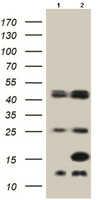 Western blot - Anti-FABP5 antibody (AB187741), expandable thumbnail