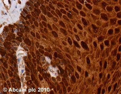 Immunohistochemistry (Formalin/PFA-fixed paraffin-embedded sections) - Anti-FABP5 antibody (AB37267)