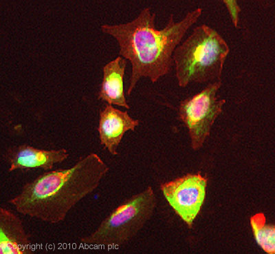 Immunocytochemistry/ Immunofluorescence - Anti-FABP5 antibody (AB84028), expandable thumbnail