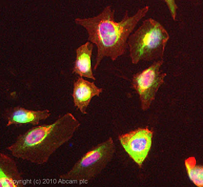 Immunocytochemistry/ Immunofluorescence - Anti-FABP5 antibody (AB84028)