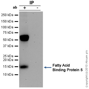 Immunoprecipitation - Anti-FABP5 antibody (AB84028), expandable thumbnail
