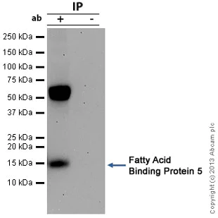 Immunoprecipitation - Anti-FABP5 antibody (AB84028)