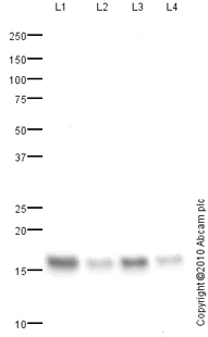 Western blot - Anti-FABP5 antibody (AB84028)