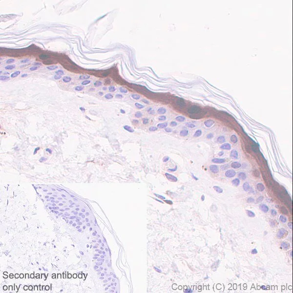 Immunohistochemistry (Formalin/PFA-fixed paraffin-embedded sections) - Anti-FABP5 antibody [EPR22552-64] (AB255276)