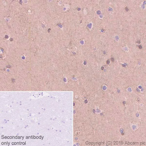 Immunohistochemistry (Formalin/PFA-fixed paraffin-embedded sections) - Anti-FABP5 antibody [EPR22552-64] (AB255276)
