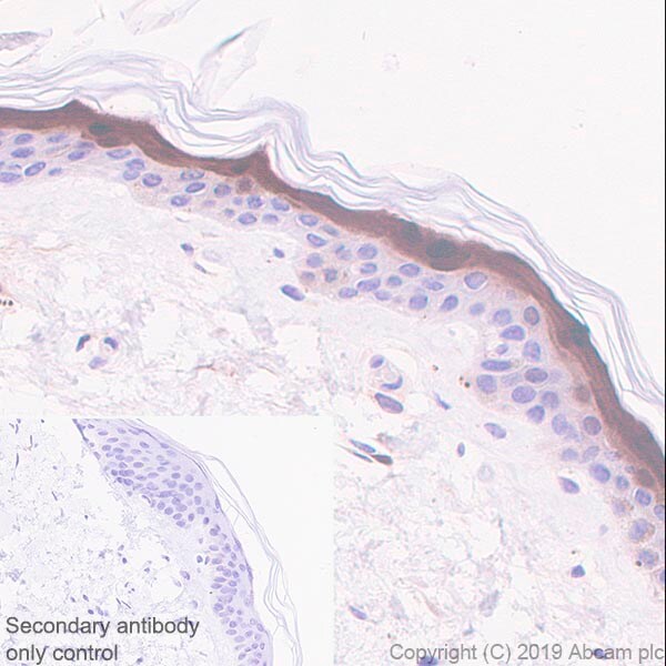 Immunohistochemistry (Formalin/PFA-fixed paraffin-embedded sections) - Anti-FABP5 antibody [EPR22552-64] - BSA and Azide free (AB255291), expandable thumbnail