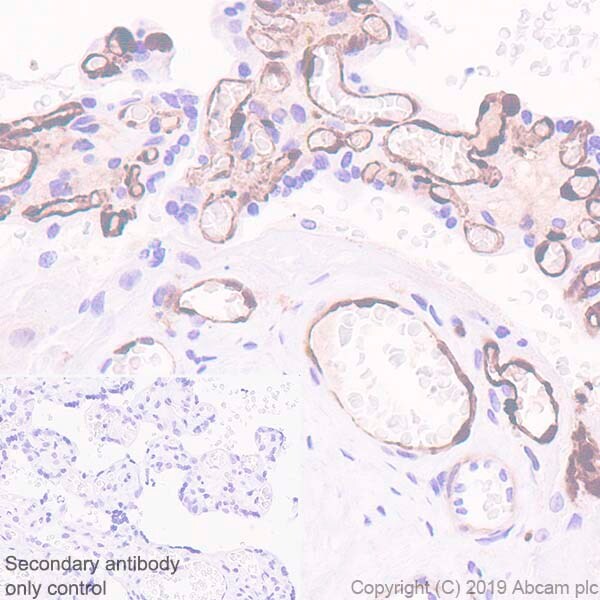 Immunohistochemistry (Formalin/PFA-fixed paraffin-embedded sections) - Anti-FABP5 antibody [EPR22552-64] - BSA and Azide free (AB255291), expandable thumbnail