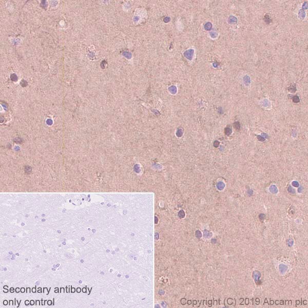 Immunohistochemistry (Formalin/PFA-fixed paraffin-embedded sections) - Anti-FABP5 antibody [EPR22552-64] - BSA and Azide free (AB255291), expandable thumbnail