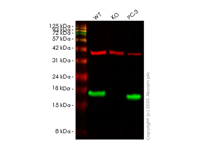 Western blot - Anti-FABP5 antibody [EPR22552-64] - BSA and Azide free (AB255291)