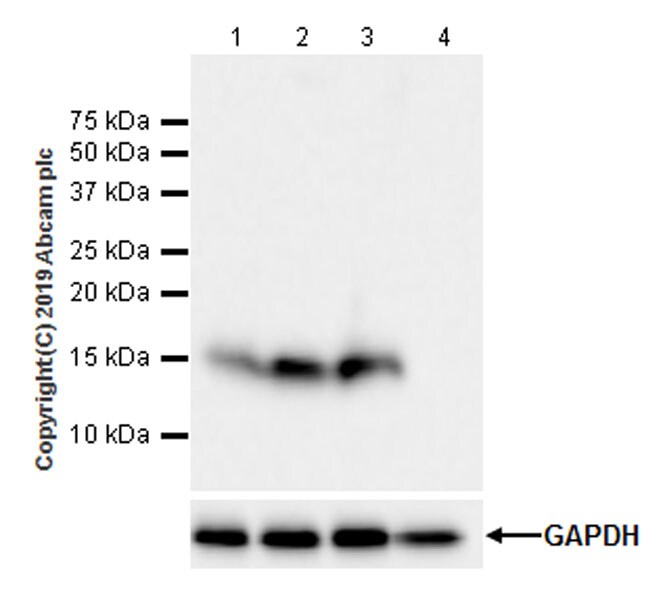 Western blot - Anti-FABP5 antibody [EPR22552-64] - BSA and Azide free (AB255291), expandable thumbnail