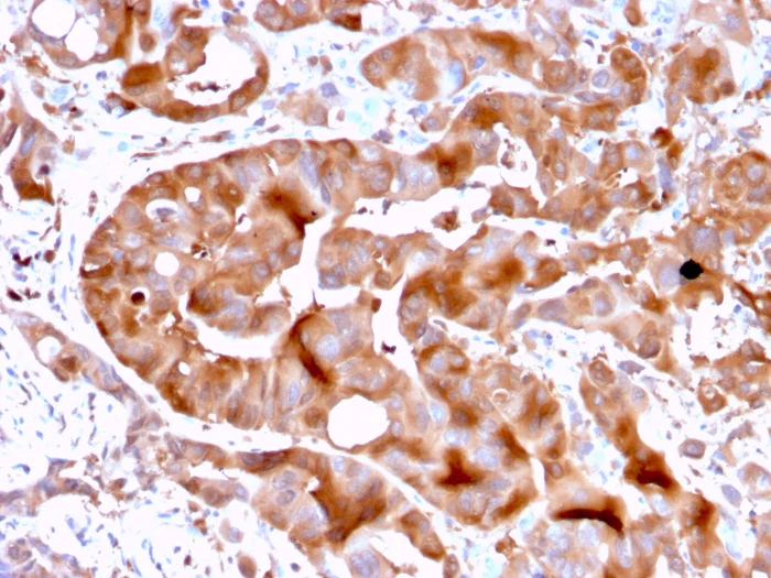 Immunohistochemistry (Formalin/PFA-fixed paraffin-embedded sections) - Anti-FABP5 antibody [FABP5/3750] - BSA and Azide free (AB268177)