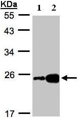 Western blot - Anti-FABP6 antibody (AB96122), expandable thumbnail