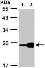 Western blot - Anti-FABP6 antibody (AB96122)