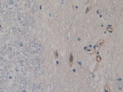 Immunohistochemistry (Formalin/PFA-fixed paraffin-embedded sections) - Anti-FABP9 antibody (AB231531), expandable thumbnail