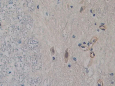 Immunohistochemistry (Formalin/PFA-fixed paraffin-embedded sections) - Anti-FABP9 antibody (AB231531)