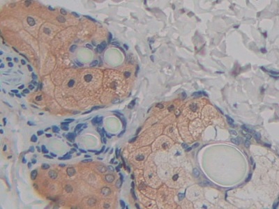Immunohistochemistry (Formalin/PFA-fixed paraffin-embedded sections) - Anti-FABP9 antibody (AB231531), expandable thumbnail