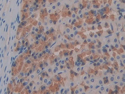 Immunohistochemistry (Formalin/PFA-fixed paraffin-embedded sections) - Anti-FABP9 antibody (ab231531), expandable thumbnail