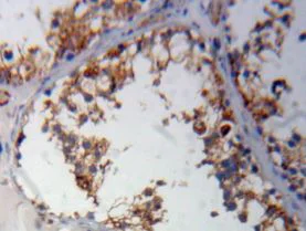 Immunohistochemistry (Formalin/PFA-fixed paraffin-embedded sections) - Anti-FABP9 antibody (AB231531)