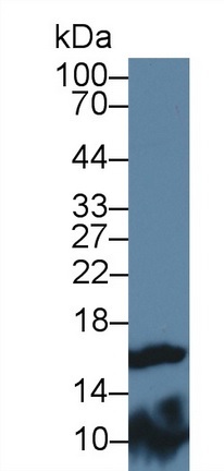 Western blot - Anti-FABP9 antibody (AB231531), expandable thumbnail