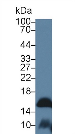 Western blot - Anti-FABP9 antibody (AB231531), expandable thumbnail