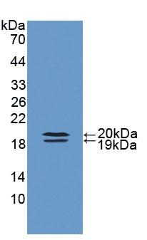 Western blot - Anti-FABP9 antibody (AB231531), expandable thumbnail