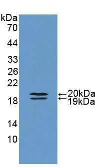 Western blot - Anti-FABP9 antibody (AB231531)