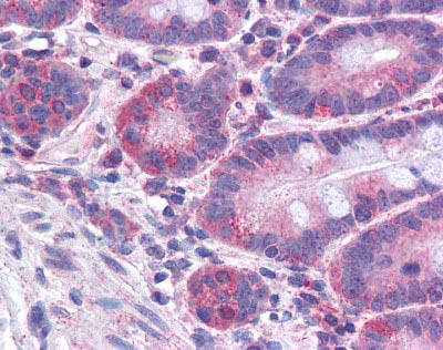 Immunohistochemistry (Formalin/PFA-fixed paraffin-embedded sections) - Anti-FACL4 antibody (AB110007), expandable thumbnail