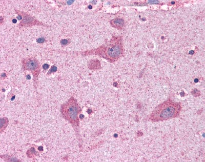 Immunohistochemistry (Formalin/PFA-fixed paraffin-embedded sections) - Anti-FACL4 antibody (AB110007), expandable thumbnail