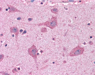 Immunohistochemistry (Formalin/PFA-fixed paraffin-embedded sections) - Anti-FACL4 antibody (AB110007)