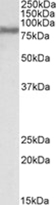 Western blot - Anti-FACL4 antibody (AB110007), expandable thumbnail