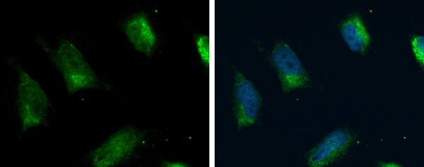 Immunocytochemistry/ Immunofluorescence - Anti-FACL4 antibody (AB227256), expandable thumbnail