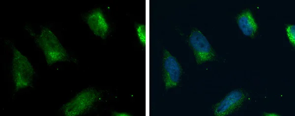 Immunocytochemistry/ Immunofluorescence - Anti-FACL4 antibody (AB227256)