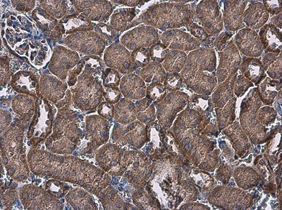 Immunohistochemistry (Formalin/PFA-fixed paraffin-embedded sections) - Anti-FACL4 antibody (AB227256), expandable thumbnail