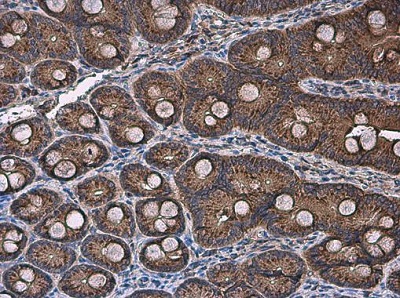 Immunohistochemistry (Formalin/PFA-fixed paraffin-embedded sections) - Anti-FACL4 antibody (AB227256), expandable thumbnail