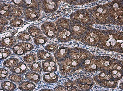 Immunohistochemistry (Formalin/PFA-fixed paraffin-embedded sections) - Anti-FACL4 antibody (AB227256)